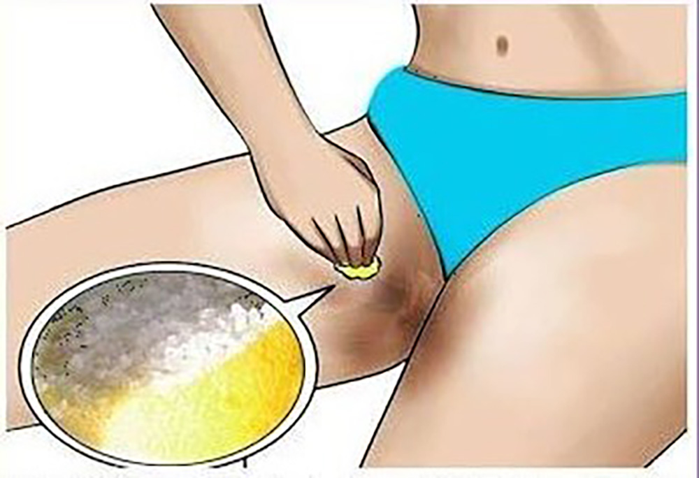 How To Lighten Dark Inner Thighs Naturally