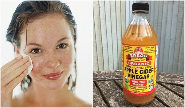 Reasons Why Apple Cider Vinegar Toner Is Getting More Popular In The Past Decade